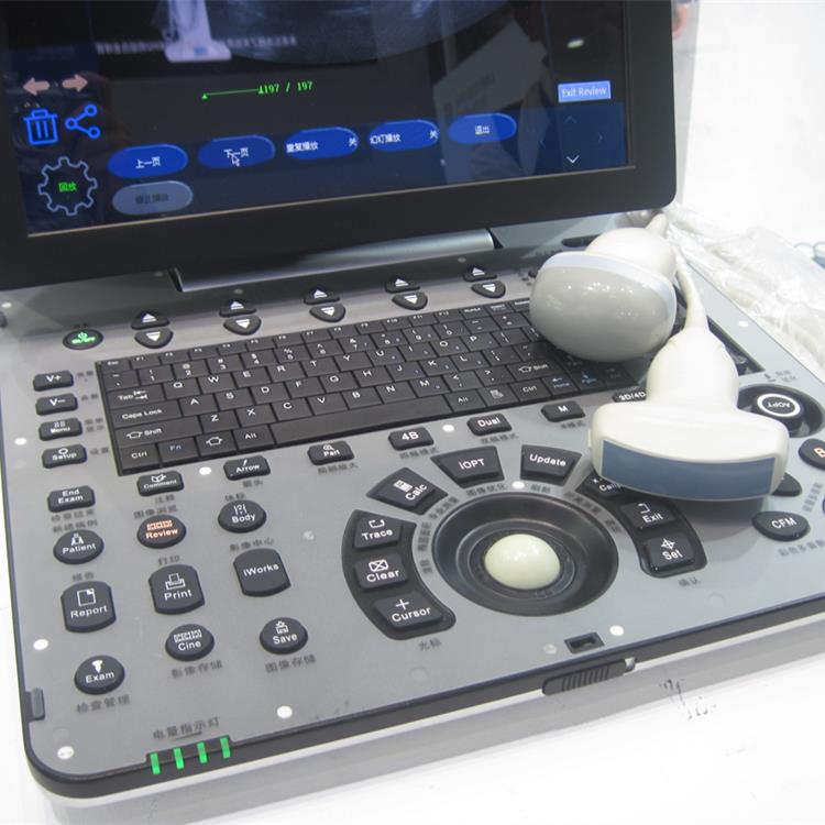 Portable Color Doppler Ultrasound