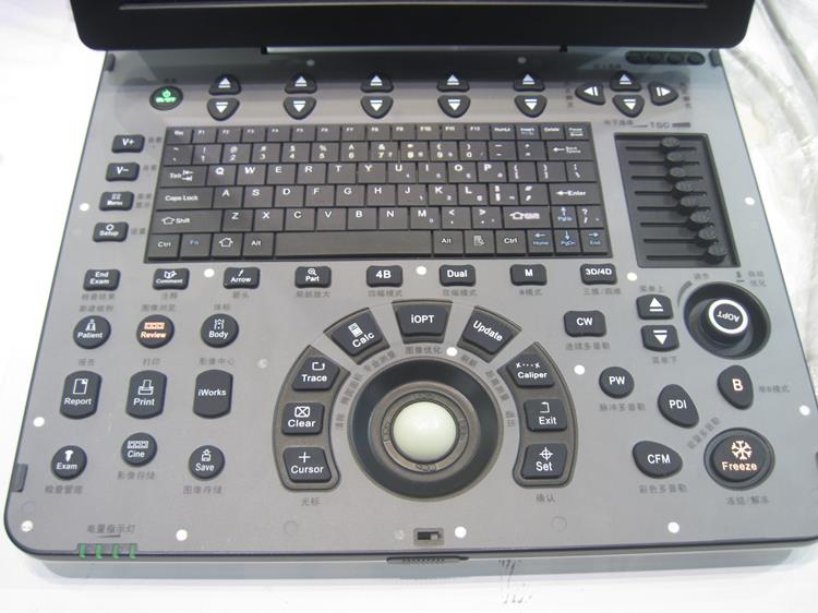 Portable Color Doppler Ultrasound