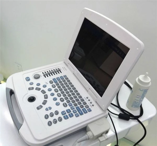 BW Digital Notebook Ultrasound System Scanner BW Digital Notebook Ultrasound System Scanner