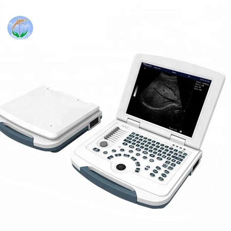 diagonastic ultrasound system