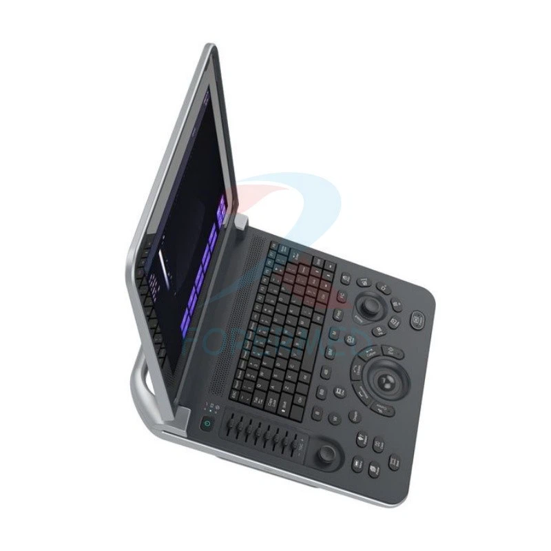 Portable Laptop Ultrasound Machine