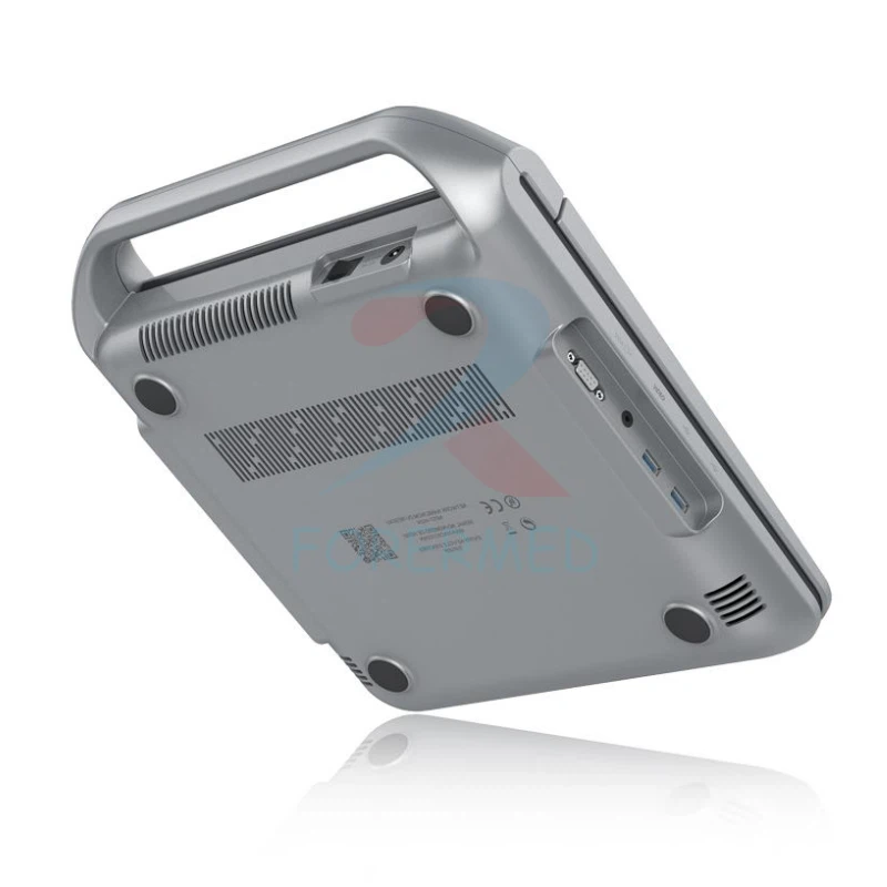 Portable Laptop Ultrasound Machine
