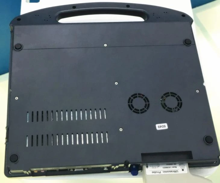 Notebook Color Doppler Ultrasound Scanner