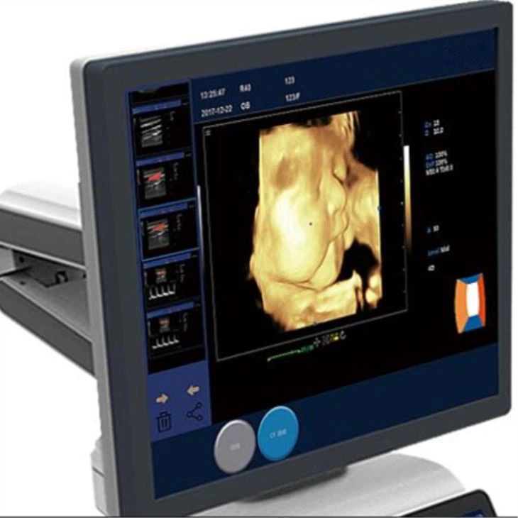 4D Trolley Color Ultrasound 4D Trolley Color Ultrasound