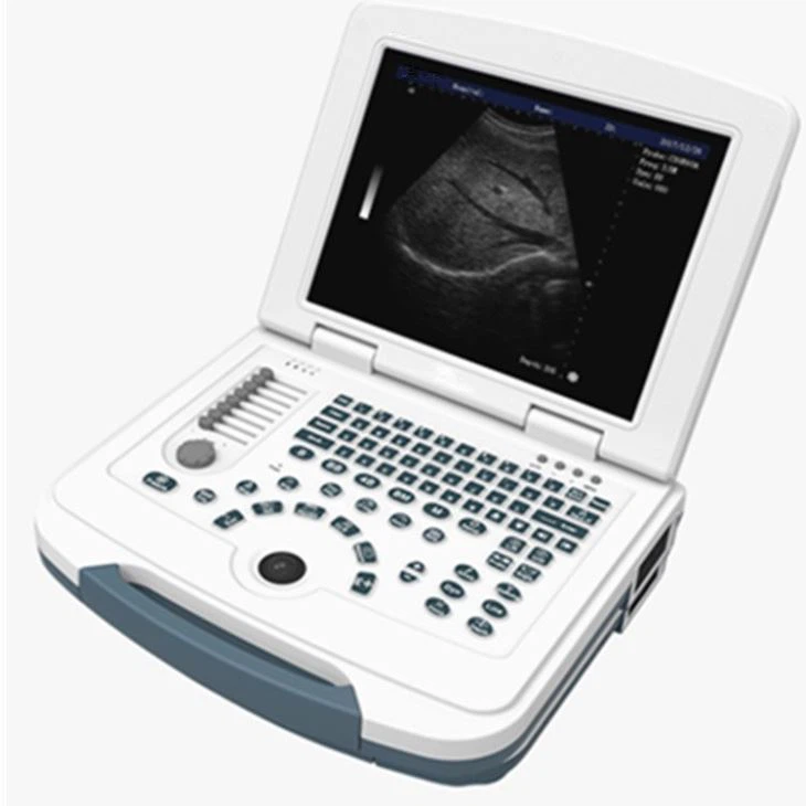 B/W Notebook Ultrasound System Scanner