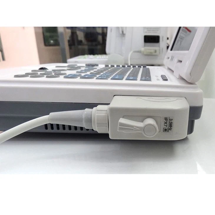 B/W Notebook Ultrasound System Scanner