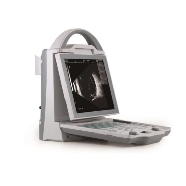 Ophthalmic Ultrasound AB Scan Biometer Pachymeter Ophthalmic Ultrasound AB Scan Biometer Pachymeter