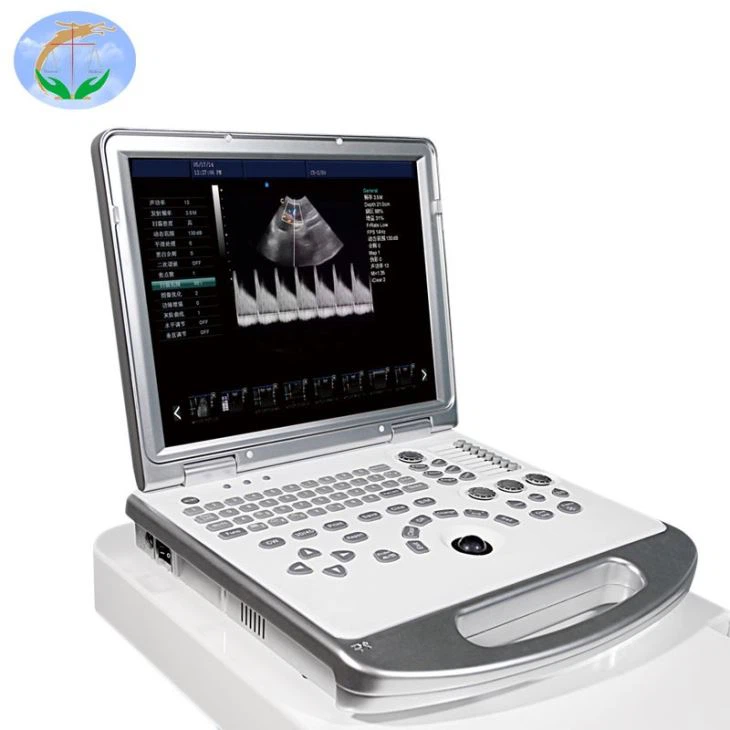 Hot Selling Portable Ultrasound Machine