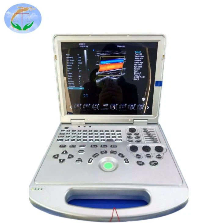 High Quality 4D Ultrasound Transducer