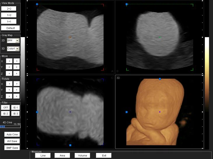 Low Price Digital Ultrasound Scanner Low Price Digital Ultrasound Scanner