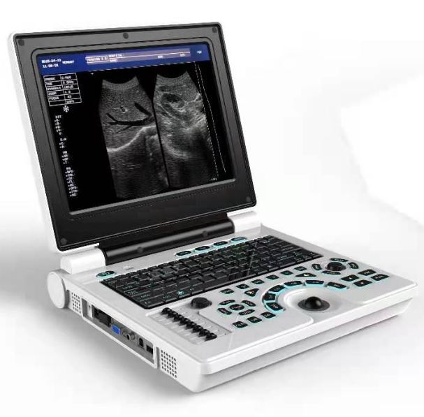 Color Doppler Ultrasonic Diagnostic System Color Doppler Ultrasonic Diagnostic System