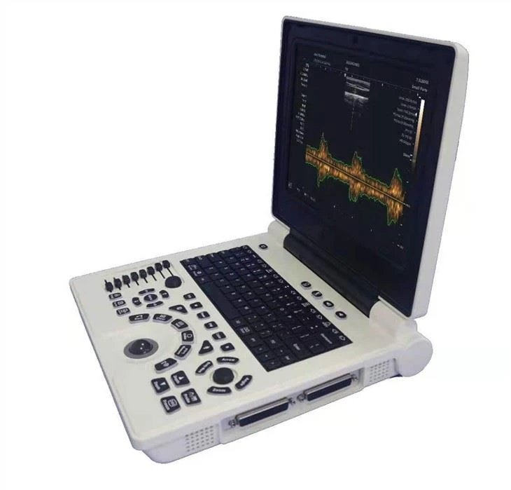 Color Doppler Ultrasonic Diagnostic System Color Doppler Ultrasonic Diagnostic System
