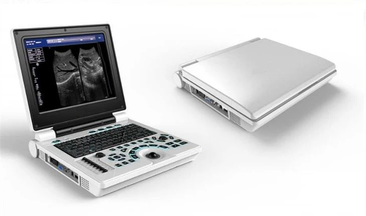 Color Doppler Ultrasonic Diagnostic System Color Doppler Ultrasonic Diagnostic System