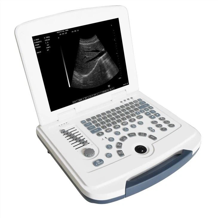 Sistem Ultrasound Laptop Digital Penuh OB-GYN