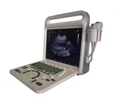 Sistem Doppler Warna Digital Penuh