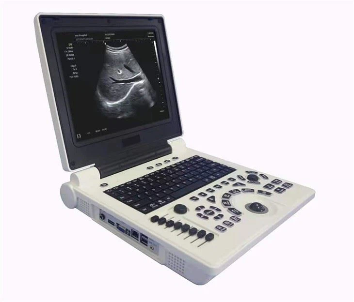 Sistem Diagnostik Ultrasonik Doppler Warna Laptop