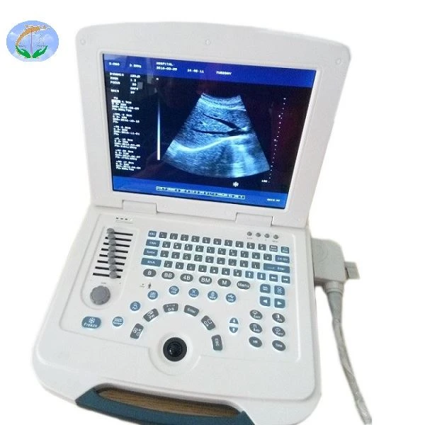 Pemindai Ultrasound Laptop Digital Penuh Untuk Rumah Sakit Dan Klinik