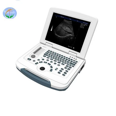 Full-Digital Laptop Ultrasound Scanner For Hospital And Clinic