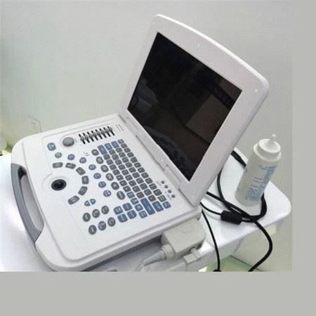 Full-Digital Laptop Ultrasound Scanner For Hospital And Clinic