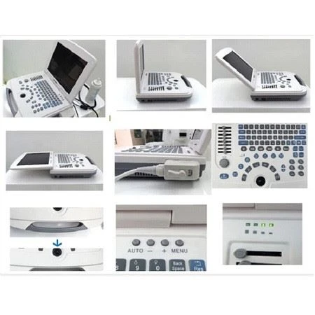 Full-Digital Laptop Ultrasound Scanner For Hospital And Clinic