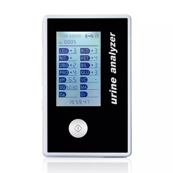Alat Analisis Urin Genggam Medis 11 Parameter Untuk Penggunaan Medis di Laboratorium Klinik Rumah Sakit