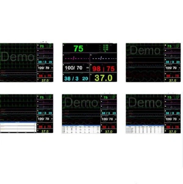 multiparameter patient monitor multiparameter patient monitor