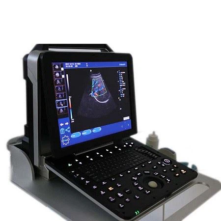 YJ-C90 High-end Portable Color Doppler Ultrasound