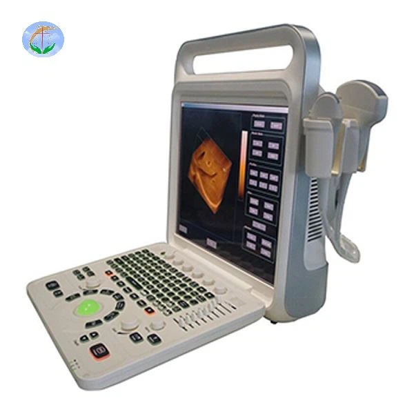 Ultrasound Sistem Doppler Warna Digital Penuh YJ-E60