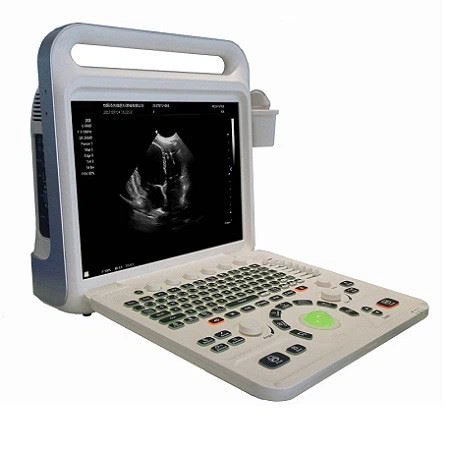 YJ-E60 Full Digital Color Doppler System Ultrasound