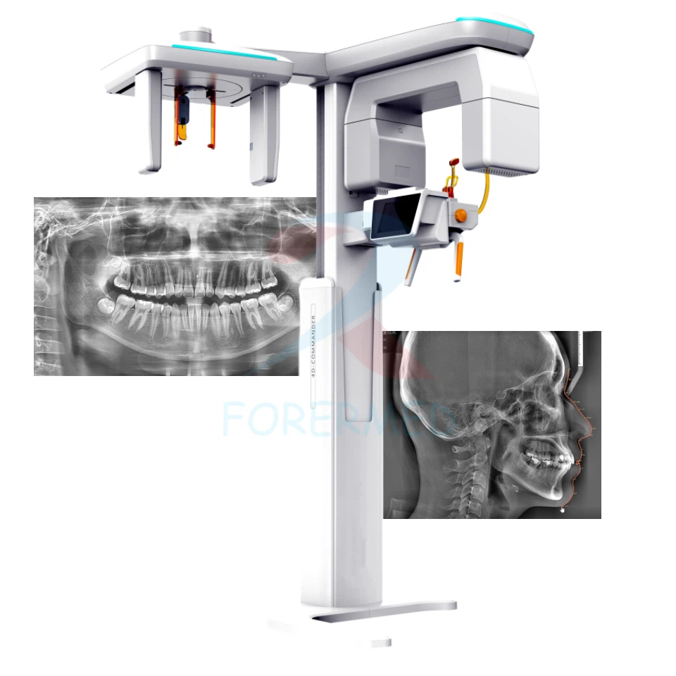 SCAN CBCT UNTUK IMPLAN GIGI