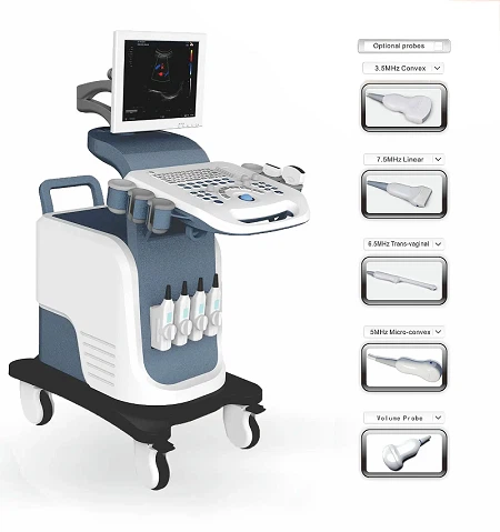 trolley ultrasound price trolley ultrasound price