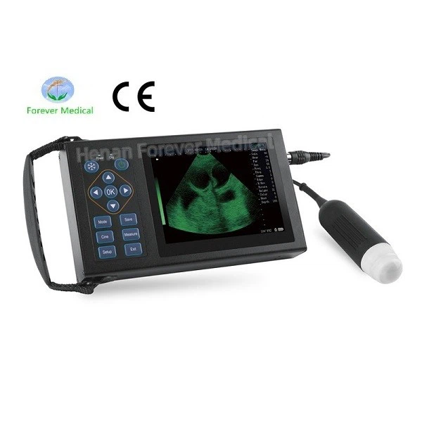 price of the ultrasound machine price of the ultrasound machine