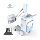 Frekuensi Tinggi Peralatan Sinar-X Digital Seluler Sistem DR X Ray