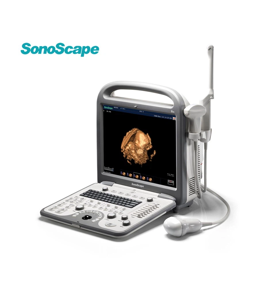 SonoScape S8